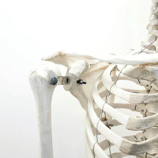 Calcium Deficiency for Bariatric Surgery Patients